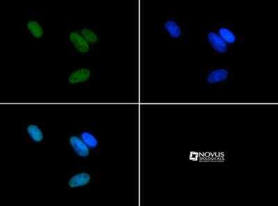 Immunocytochemistry/Immunofluorescence: Histone H3 [Asym-dimethyl Arg17] Antibody [NB21-1132] - Histone H3.2 R17me2a antibody was tested in HeLa cells with FITC (green). Nuclei were counterstained with DAPI (blue).
